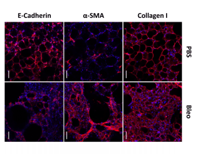 Representative immunofluorescence analysis of Collagen I, α-SMA and E-Cadherin in control (PBS), and fibrotic (Bleo) 3D-LTCs after 48 h in culture