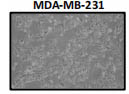 The cell morphology of triple-negative MDA-MB-231 cells
