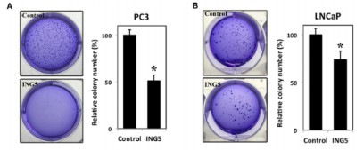 Effect of ING5 on the migration of PC3 and LNCaP cells