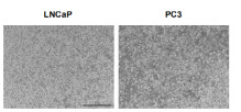 The cell morphology of PC3 and LNCaP cells