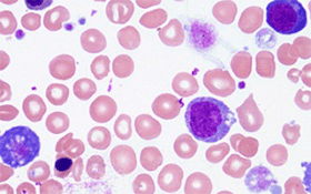 Peripheral Blood Mononuclear Cells (PBMCs)
