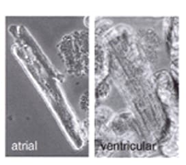 Typical phase contrast micrographs of atrial and ventricular cardiomyocytes