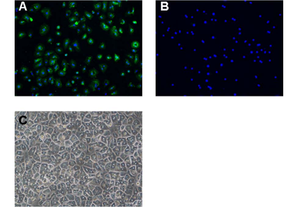 Immunofluorescent images of isolated human hepatocytes