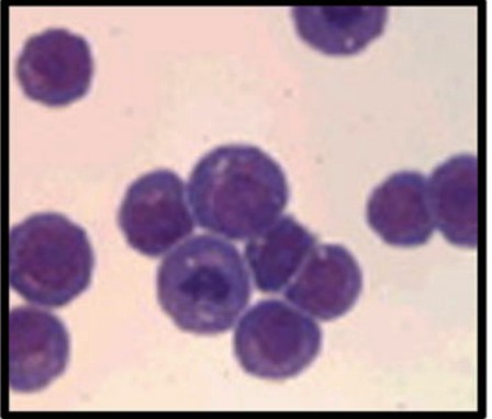 HL-60 cells with Romanowsky stain