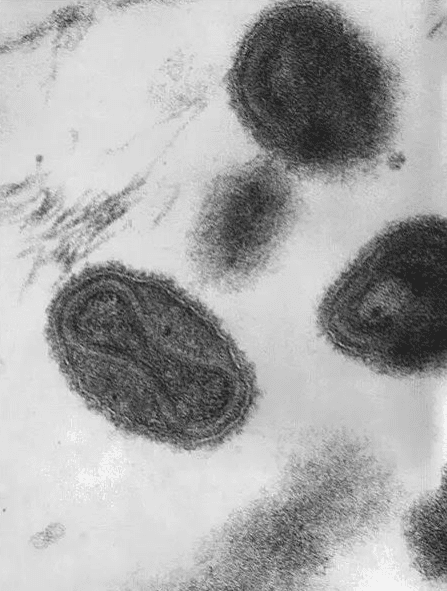 Will Smallpox Research Help in the Treatment of Monkeypox?